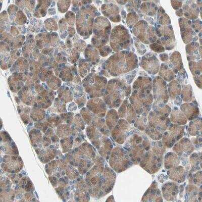 Immunohistochemistry-Paraffin: SMIM8 Antibody [NBP1-84249]