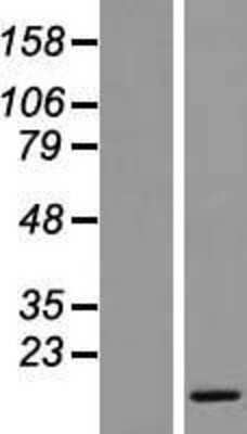 Western Blot: SMIM8 Overexpression Lysate [NBL1-08519]