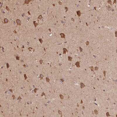 Immunohistochemistry: C6orf163 Antibody [NBP2-49066]