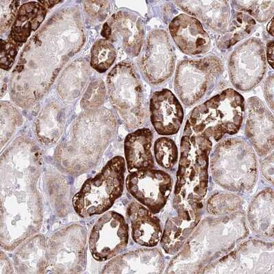 Immunohistochemistry-Paraffin: C6orf163 Antibody [NBP1-94165]