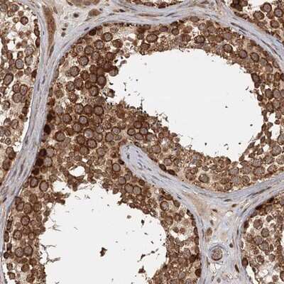 Immunohistochemistry-Paraffin: FAXC Antibody [NBP1-90579]