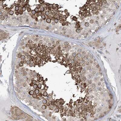 Immunohistochemistry-Paraffin: SOGA3 Antibody [NBP1-90575]