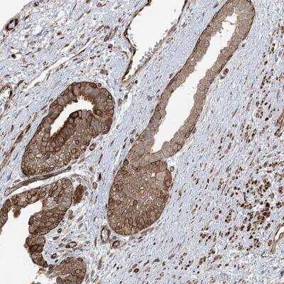Immunohistochemistry-Paraffin: SOGA3 Antibody [NBP2-34001]