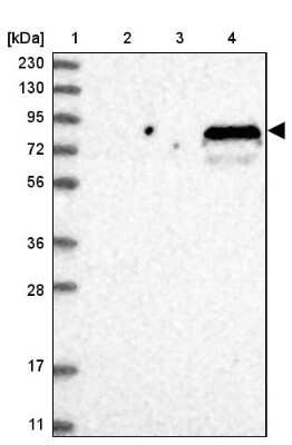 Western Blot: SOGA3 Antibody [NBP1-90575]