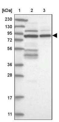 Western Blot: SOGA3 Antibody [NBP2-34001]