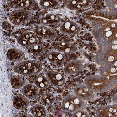 Immunohistochemistry: Methyltransferase Like 24 Antibody [NBP1-90565]