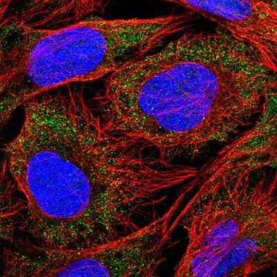 Immunocytochemistry/ Immunofluorescence: SLC18B1 Antibody [NBP2-56822]