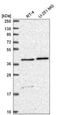 Western Blot: SLC18B1 Antibody [NBP2-56822]