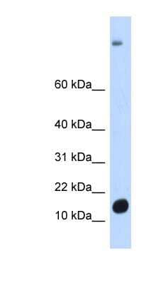 Western Blot: C6orf201 Antibody [NBP1-70476]