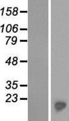 Western Blot: C6orf201 Overexpression Lysate [NBP2-04541]