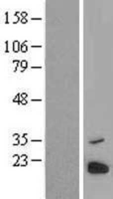 Western Blot: PRED31 Overexpression Lysate [NBL1-08525]