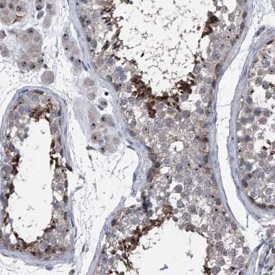 Immunohistochemistry-Paraffin: CEP85L Antibody [NBP1-90779]