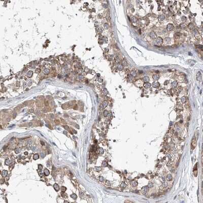 Immunohistochemistry-Paraffin: CEP85L Antibody [NBP1-90780]