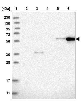 Western Blot: CEP85L Antibody [NBP1-90778]