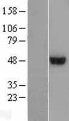 Western Blot: ARMT1 Overexpression Lysate [NBL1-08526]