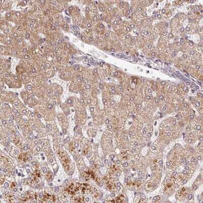 Immunohistochemistry: C6orf222 Antibody [NBP2-49276]