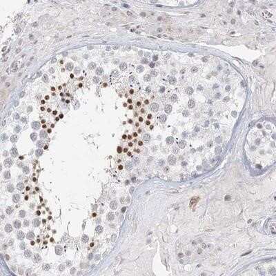 Immunohistochemistry-Paraffin: C6orf222 Antibody [NBP1-90494]