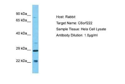 Western Blot: C6orf222 Antibody [NBP2-84565]