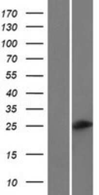 Western Blot: C6orf223 Overexpression Lysate [NBP2-10243]