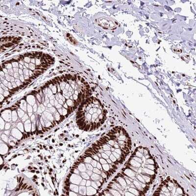 Immunohistochemistry-Paraffin: C6orf226 Antibody [NBP1-91739]