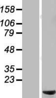 Western Blot: C6orf226 Overexpression Lysate [NBL1-12609]