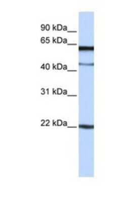 Western Blot: G6b/C6orf25 Antibody [NBP1-69388]