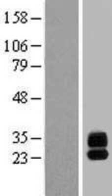 Western Blot: G6b/C6orf25 Overexpression Lysate [NBP2-05686]