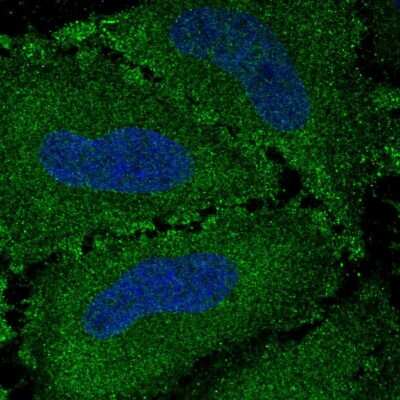 Immunocytochemistry/ Immunofluorescence: VWA7 Antibody [NBP2-56840]