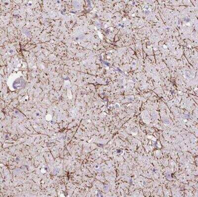 Immunohistochemistry-Paraffin: VWA7 Antibody [NBP2-30543]