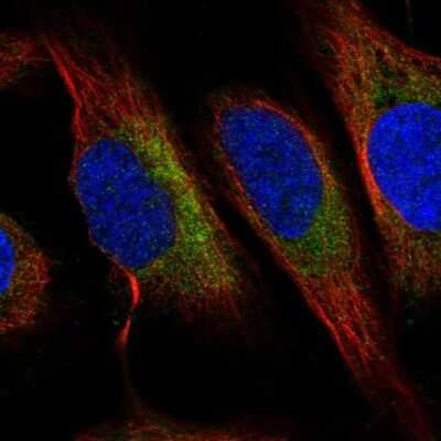 Immunocytochemistry/ Immunofluorescence: C6orf47 Antibody [NBP2-48828]