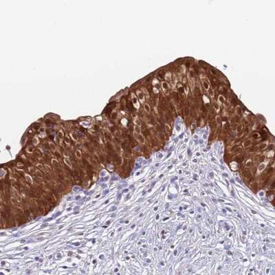 Immunohistochemistry-Paraffin: C6orf47 Antibody [NBP2-48828]