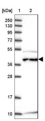 Western Blot: C6orf47 Antibody [NBP2-48828]