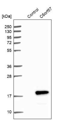 Western Blot: SDHAF4 Antibody [NBP1-86324]