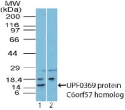 Western Blot: SDHAF4 Antibody [NBP2-27170]