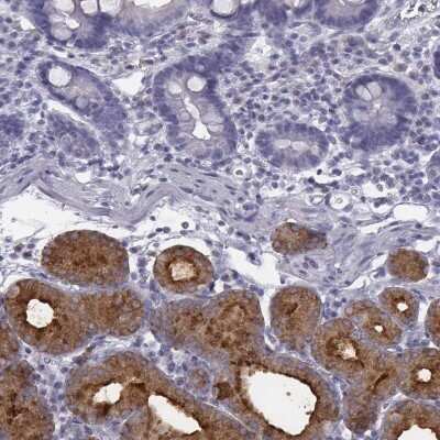Immunohistochemistry-Paraffin: C6orf58 Antibody [NBP2-48738]