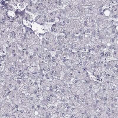 Immunohistochemistry-Paraffin: C6orf58 Antibody [NBP2-48738]