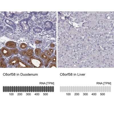 Immunohistochemistry-Paraffin: C6orf58 Antibody [NBP2-48738]