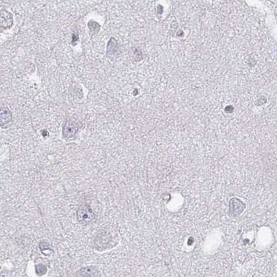 Immunohistochemistry-Paraffin: C6orf58 Antibody [NBP2-48738]