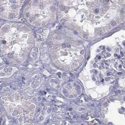 Immunohistochemistry-Paraffin: C6orf58 Antibody [NBP2-48738]