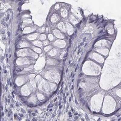 Immunohistochemistry-Paraffin: C6orf58 Antibody [NBP2-48738]