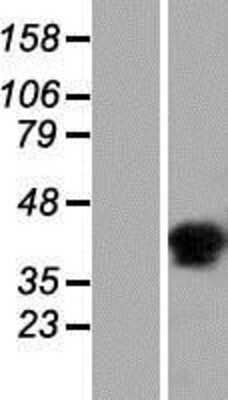 Western Blot: C6orf58 Overexpression Lysate [NBP2-08771]