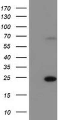 Western Blot: SAYSD1 Antibody (OTI2H3) [NBP2-02000]