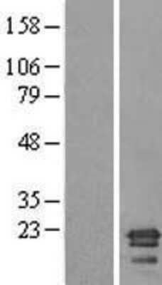 Western Blot: SAYSD1 Overexpression Lysate [NBL1-08536]