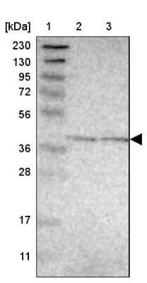 Western Blot: GPALPP1 Antibody [NBP1-84240]