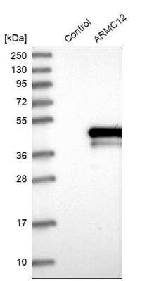 Western Blot: ARMC12 Antibody [NBP1-82059]