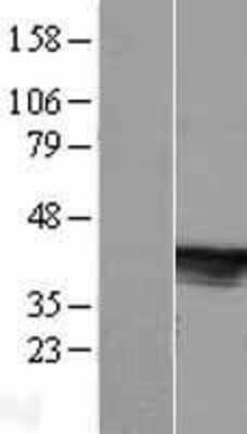 Western Blot: ARMC12 Overexpression Lysate [NBL1-08539]