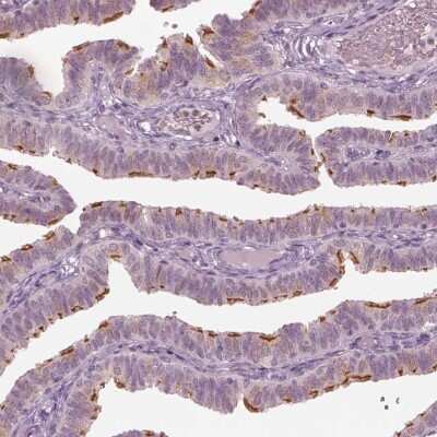 Immunohistochemistry-Paraffin: CCDC170 Antibody [NBP2-48579]