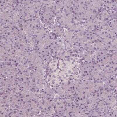 Immunohistochemistry-Paraffin: CCDC170 Antibody [NBP2-48579]