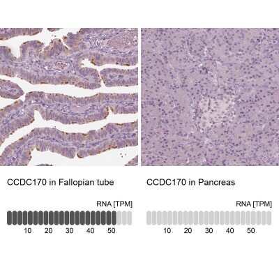 Immunohistochemistry-Paraffin: CCDC170 Antibody [NBP2-48579]