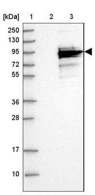 Western Blot: CCDC170 Antibody [NBP2-37860]